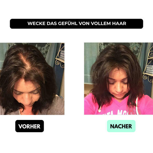 BELEZA™ Hair Volume